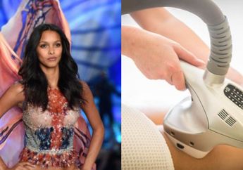 Velashape, Andalan Model Victoria's Secret untuk Hilangkan Selulit, Ampuh Bikin Kulit Mulus! Penasaran?
