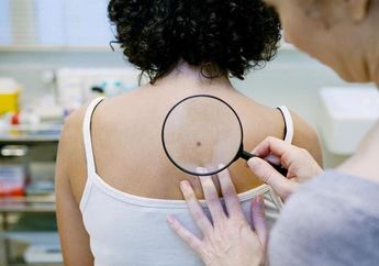 Mulai Dari Penggunaan Ponsel, Ini Sederet Kebiasaan Buruk yang Sering Kita Lakukan yang Bisa Menyebabkan Kanker Kulit