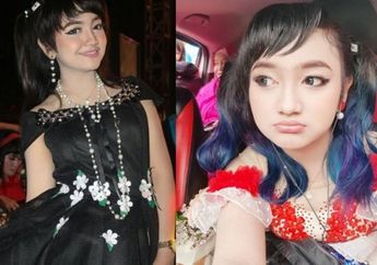 Begini Keadaan Pendangdut Jihan Audy, Pasca Kecelakaan di Jalur Pantura