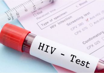 Lakukan Tes HIV di Usia Ini, Lebih Akurat loh, Begini Kata Pakarnya
