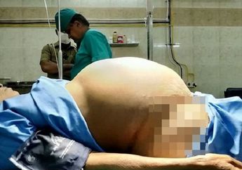 Dua Tahun Jalani Hidup Seperti Orang Hamil, Isi Perut Wanita Ini Justru Bikin Merinding