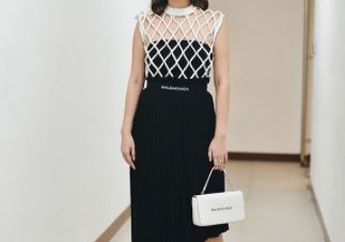 Astaga! Kasihan, Jelang Konser Bunga Citra Lestari Alami Ini Pada Kakinya