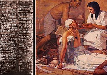 Ternyata, Dokter Sumerian Mengobati Penyakit Dengan Mantra Sihir dan Obat-obatan