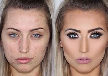 Kulit Berjerawat Tetap Bisa Mengenakan Makeup loh, yuk Simak Tahapannya!
