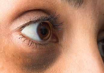 Tak Cuma Perawatan, Konsumsi 4 Makanan Ini Bisa Bantu Hilangkan Mata Pandamu loh!