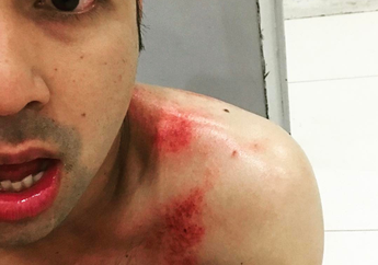 Raffi Ahmad Jadi Korban Kekejaman Enter Wind