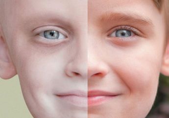 Jangan Dianggap Remeh, Kenali Gejala dan Tanda 6 Kanker yang Umum Menyerang Anak