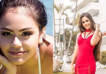 YouTuber Cantik 'Mati Otak' Setelah Kepalanya Terkena Peluru Nyasar