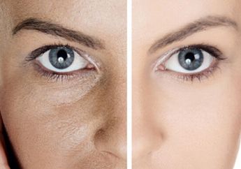 Pori-pori Wajah Besar, Atasi dengan Perawatan Berikut Ini yuk