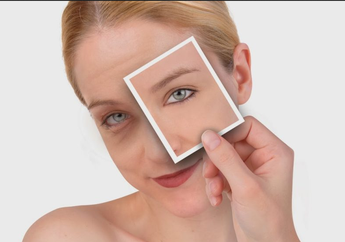 Masalah Dark Eye Circle Nggak akan Hilang Jika Kamu Masih Lakukan 5 Kebiasaan Ini 