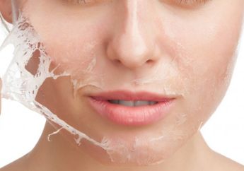 Setelah Lakukan Chemical Peeling, 3 Perawatan Ini Harus Kamu Lakukan Agar Kulit Tampak Cerah