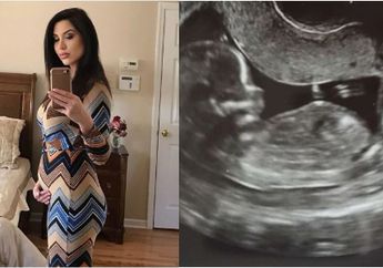 Alami Endometriosis dan Menopause Dini, Wanita Ini Tetap Bisa Hamil, Begini Kisahnya