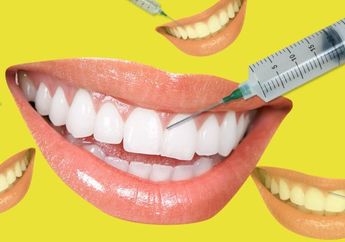 Awas, Ternyata Tren Filler Gusi Berbahaya Bagi Penggunanya