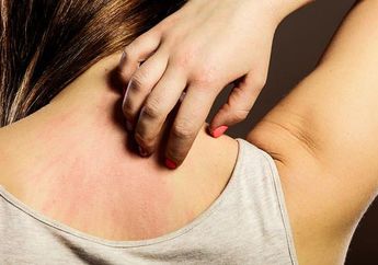 Bingung Membedakan Psoriasis Atau Kulit Kering, Simak Penjelasannya di Sini yuk!