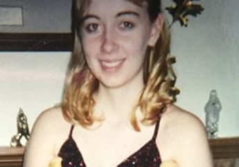 Malu Punya Kaki Tak Seimbang, Wanita Satu Anak Lakukan Amputasi 