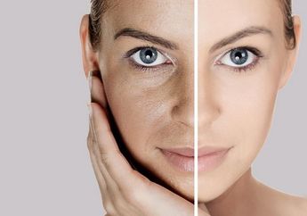 Ini loh Perbedaan Antara Kulit Kering dan Dehidrasi, Kamu Wajib Tahu nih!