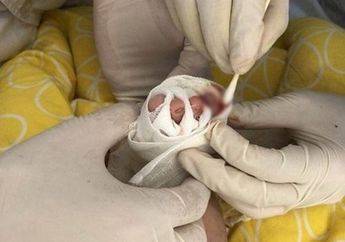 Terlambat Diketahui Orang Tuanya, Jari kaki Bayi Mungil Bakal Diamputasi