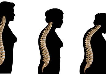 Wanita Lebih Berisiko Terkena Osteoporosis loh, Ini 5 Alasan Penyebabnya