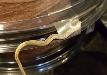 Wanita Ini Syok, Ada Hewan Persis Ular di Bungkus Coklat Delivery Order