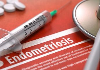 Yuk Ketahui Apa Penyebab Endometriosis, Wanita Wajib Tahu nih!