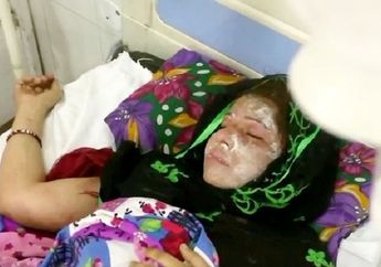 Kejam, Suami Siram Wajah Istri Dengan Cairan Asam Karena Tak Melahirkan Bayi Laki-laki