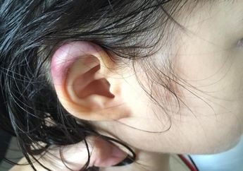 Diduga Disiksa Gurunya, Telinga Seorang Anak TK Memar Hingga Bermimpi Buruk Tiap Malam Mengatakan Hal Menyayat Hati Ini