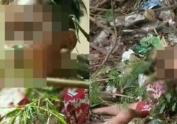 Netizen di Facebook Bagikan Cerita Miris, Bocah SD Terpeleset Hingga Batang Kayu Menancap di Rahang Sampai Menembus Mulut