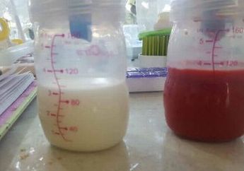 Seorang Ibu Bagikan Foto ASI Bercampur Gumpalan Darah, Ternyata Ini Penyebabnya