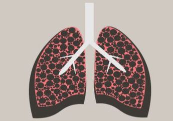 3 Mitos Tentang Tuberkulosis yang Tidak Perlu Kamu Percaya Lagi