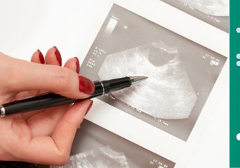 Dokter: Harapan Hidup Penderita Kanker Serviks Stadium 4 Hanya 10 Persen 