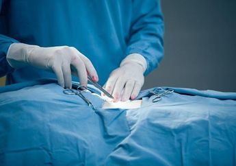 Langkah Pengobatan Medis Pasien Kanker Serviks Sesuai dengan Stadiumnya 