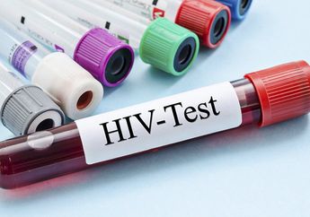 Tes HIV Efektif Dilakukan pada Usia Ini, Mau Tahu? Intip yuk Kata Pakarnya