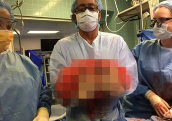 Dikira Obesitas, Nyatanya Penyakit Berbahaya yang Ada di Perut Pria Ini