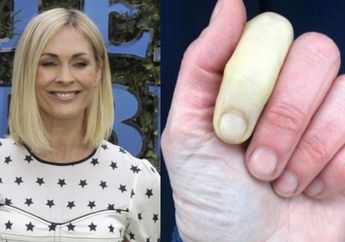 Mengidap Penyakit Langka, Presenter TV Jenni Falconer Kejutkan Penggemar Lewat Foto Jari Tangannya