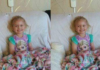 Akibat Bermain Makeup Kit, Bocah 3 Tahun Alami Luka Bakar Hingga Dilarikan ke Rumah Sakit