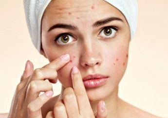 Inilah Penyebab Mengapa Seseorang Begitu Mudah Jerawatan