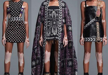 Cerita Inspiratif Winnie Harlow yang Sukses Jadi Model Terkenal Meski Mengidap Penyakit Vitiligo di Kulitnya