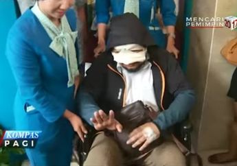 Sudah Bisa Melihat Huruf, Ini Kondisi Terakhir Novel Baswedan Pasca Disiram Air Keras