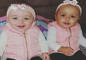 Unik! Kalani dan Jarani, Dua Bayi Kembar dengan Warna Kulit Berbeda yang Jadi Simbol Perlawanan Rasisme