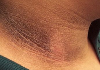 Singkirkan Leher Hitam Nggak Perlu Mahal, Bisa Pakai Bahan Rumahan Ini, Mau Tahu?