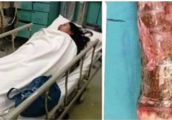 Bikin Ngilu! Wanita ini Menggunakan Sex Toys dari  Singkong, Kok Bisa?