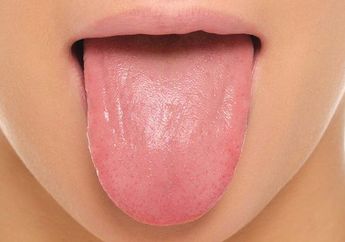 Iyuh! Kalau Lidah Jarang Dibersihkan Bisa Berbulu dan Jamur Loh!