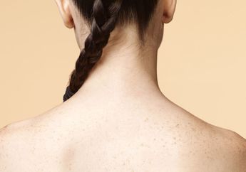 Sering Diabaikan, 7 Masalah Sepele Ini Bikin Jerawat Muncul di Punggung