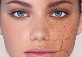 Malu Karena Kulit Kering dan Kasar? Ini Rekomendasi 4 Produk untuk Hindarkan Kamu dari Kulit Kering