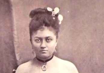 GILA! Seorang Wanita Dengan 2 Kemaluan, 3 Kaki, dan 4 Payudara Ini, Pernah Menjadi PSK Terkenal di Paris