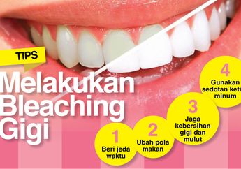 Percantik Penampilan dengan Memutihkan &lsquo;Bleaching&rsquo; Gigi? Awas Bisa Iritasi Gusi Loh!