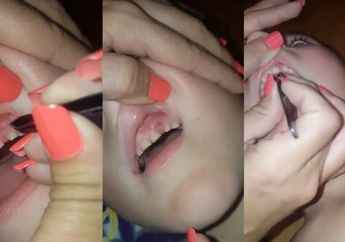 Waduh, Ibu Ini Menemukan Sesuatu di Gusi Putranya Gara-Gara Suka Menggigit Kuku.... Seram Banget!