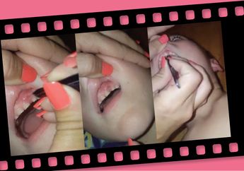 Waspada, Kebiasaan Anak Gigit Kuku Punya Akibat yang Sangat Mengerikan