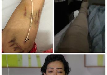 Kanker Meradang di Selangkangan Julia Perez, Rasa Sakit Itu Ia Lawan dengan Senyum