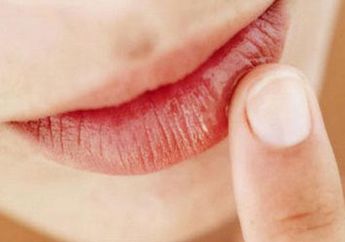 Bibir Pecah-Pecah Bikin Nggak Pede? Ini 5 Bahan Alami Pelembab Bibir